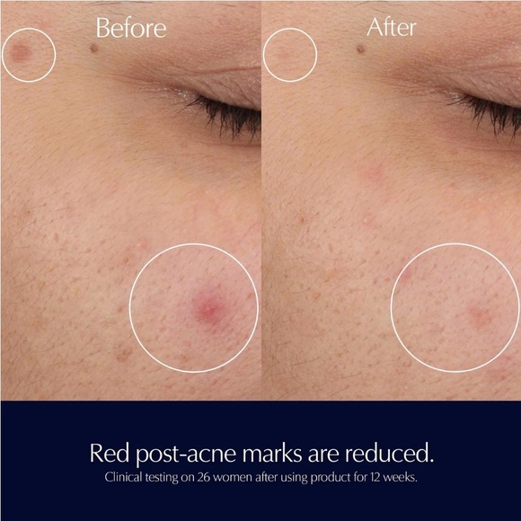 Estée Lauder Advanced Night Repair Rescue Solution Serum - Picture 4 of 10